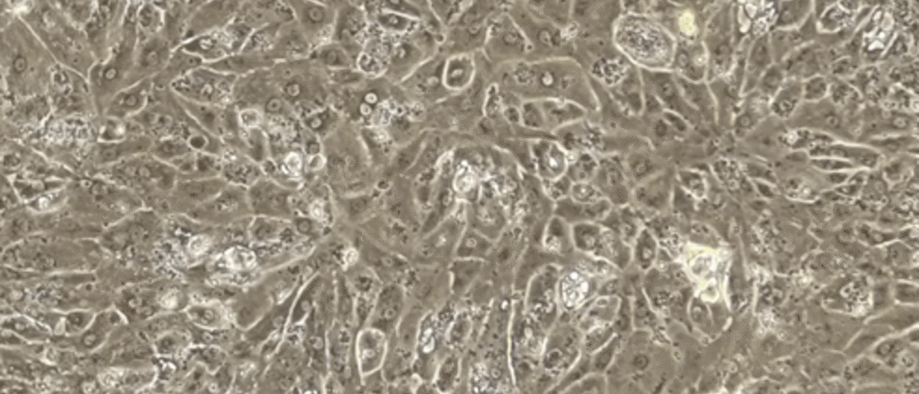 Beating cardiomyocytes