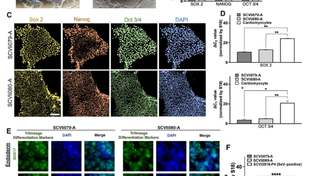 pulmonary_hypertension_paper