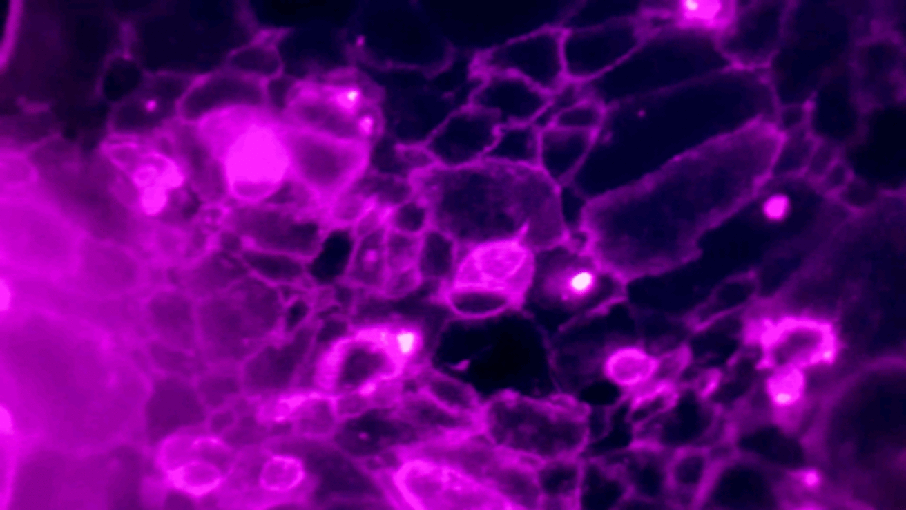 pharmacogenetics in ipsc derived cv cells